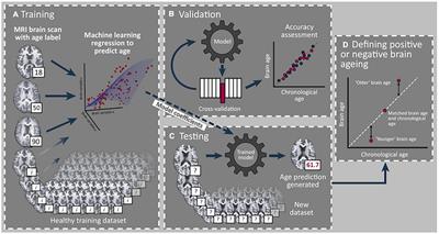 Brain-Predicted Age Difference Moderates the Association Between Muscle Strength and Mobility